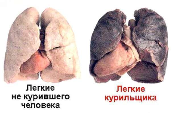 Отказ от курения - профилактика рака