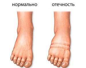 Посмотрите, как выглядят ваши ножки. Фото с сайта http://www.moya-lyalyas.ru/
