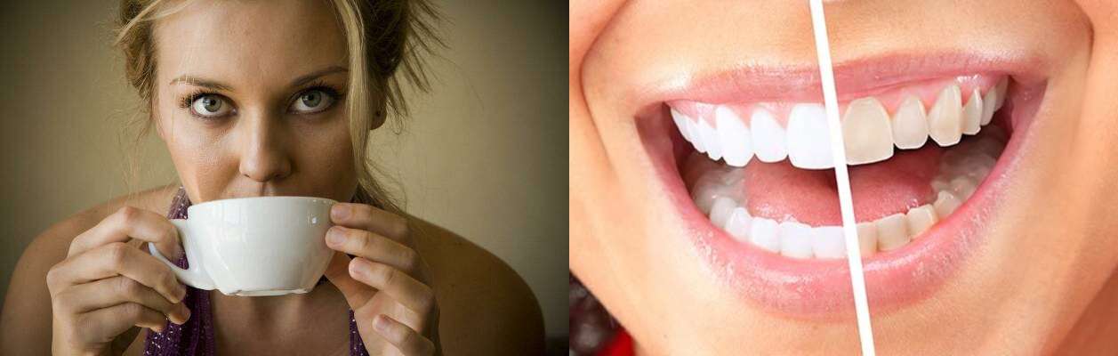 Потемнение зубной эмали от пищи