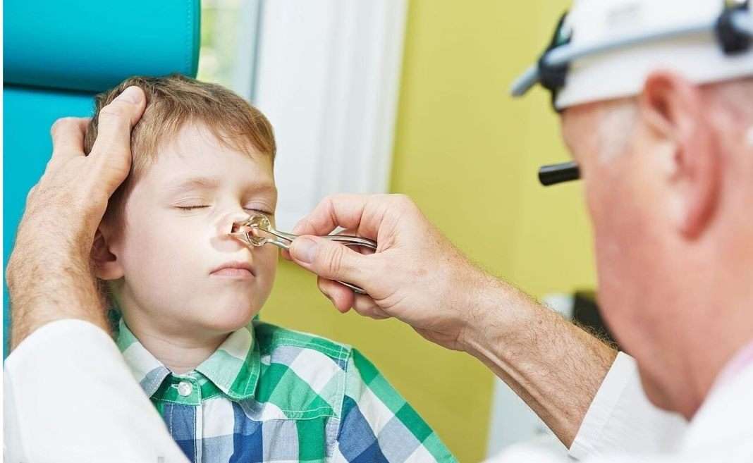как узнать сломан нос или нет у ребенка