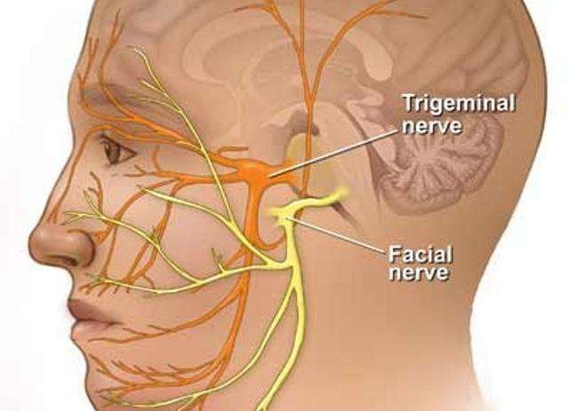 лицевой тройничный нерв симптомы лечение